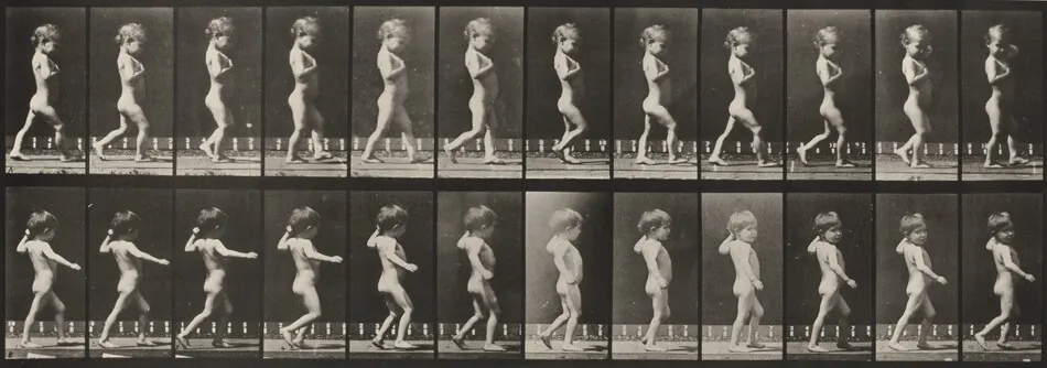 Plate Number 540. A: Bowlegs, boy. B: Spinal caries, girl walking by Eadweard Muybridge