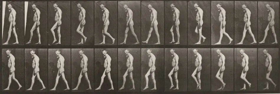 Plate Number 555. Muscular atrophy of legs, adult, walking by Eadweard Muybridge