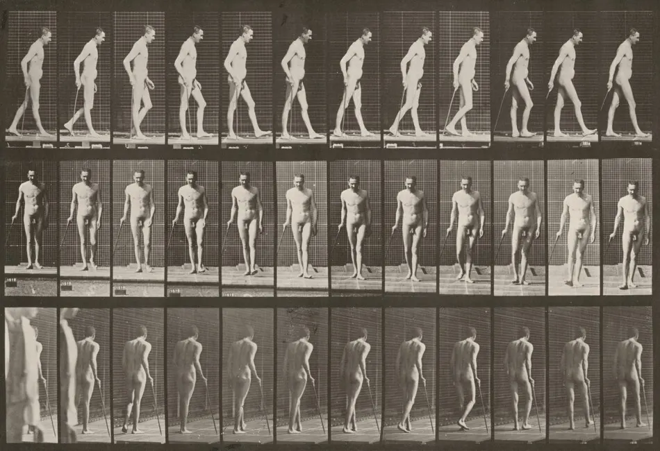 Plate Number 559. Partial paraplegia, walking with cane by Eadweard Muybridge