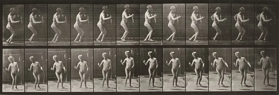 Plate Number 561. Hydrocephalus, walking by Eadweard Muybridge